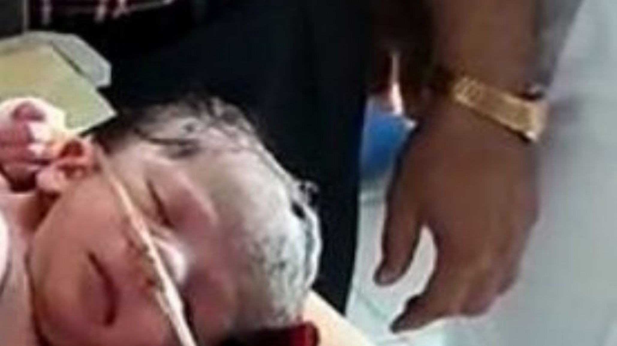 India: da a luz a un bebé con 4 piernas y 3 manos