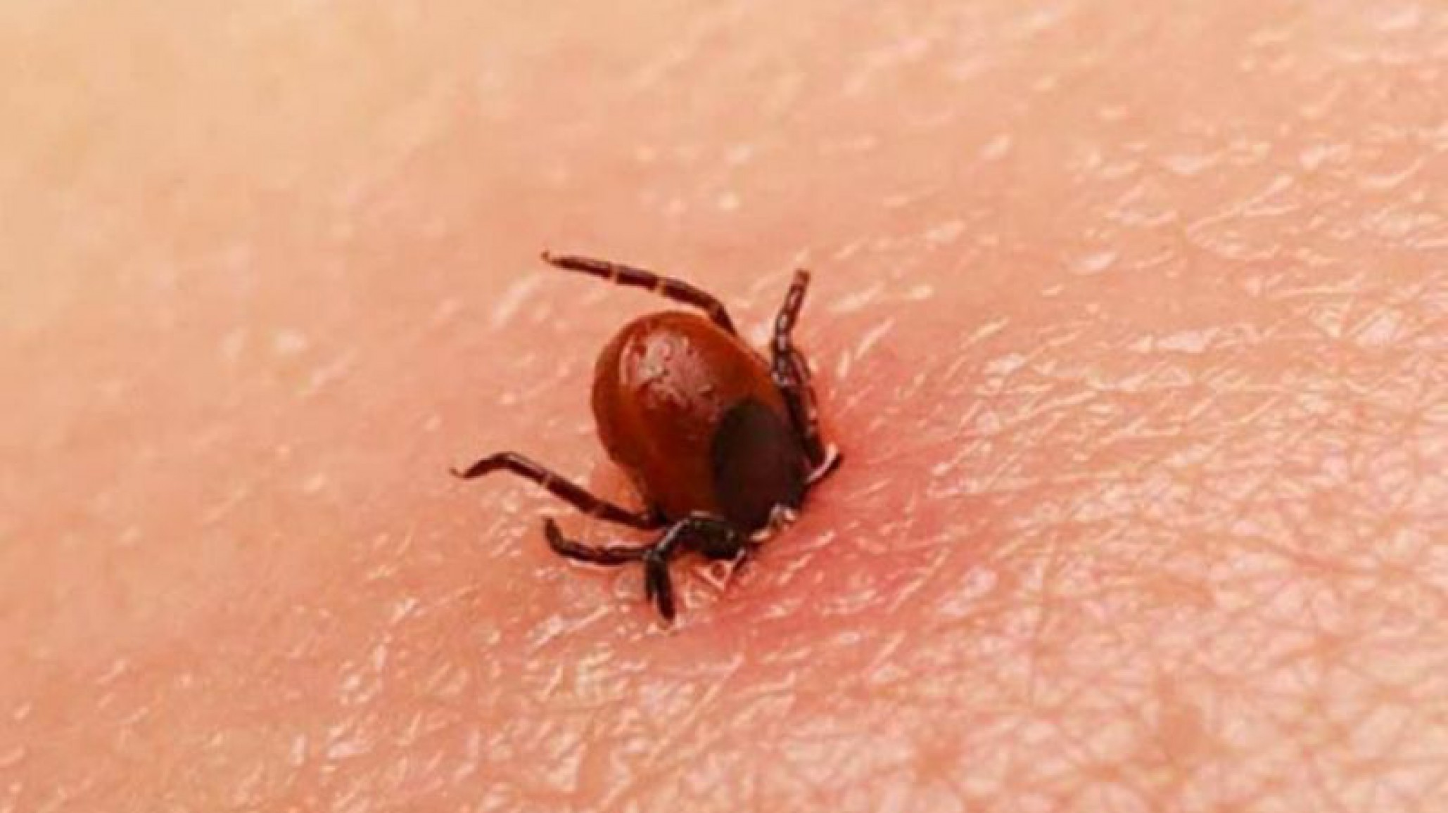 Una familia perdió la vida como consecuencia de la picadura de una garrapata