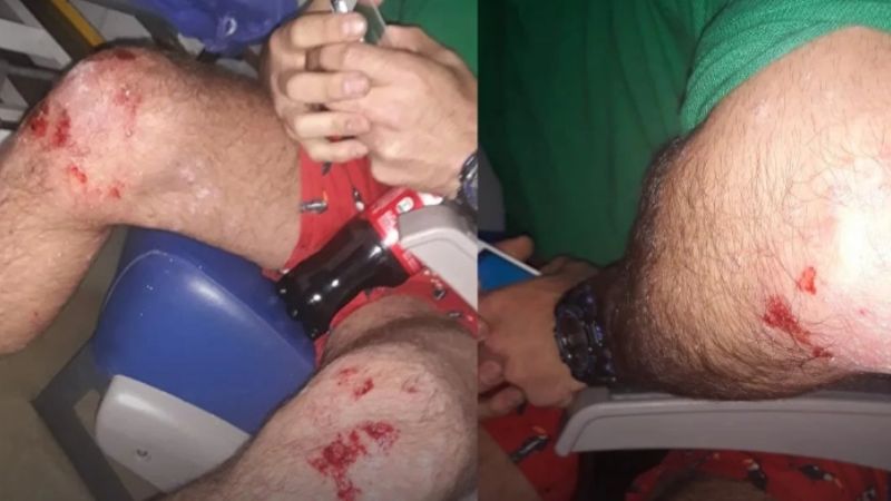 Un hombre persiguió y atacó con un látigo a una pareja gay en Villa Urquiza