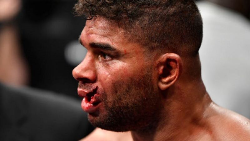 UFC: Luchador es noqueado con un golpe que literalmente le explota el labio
