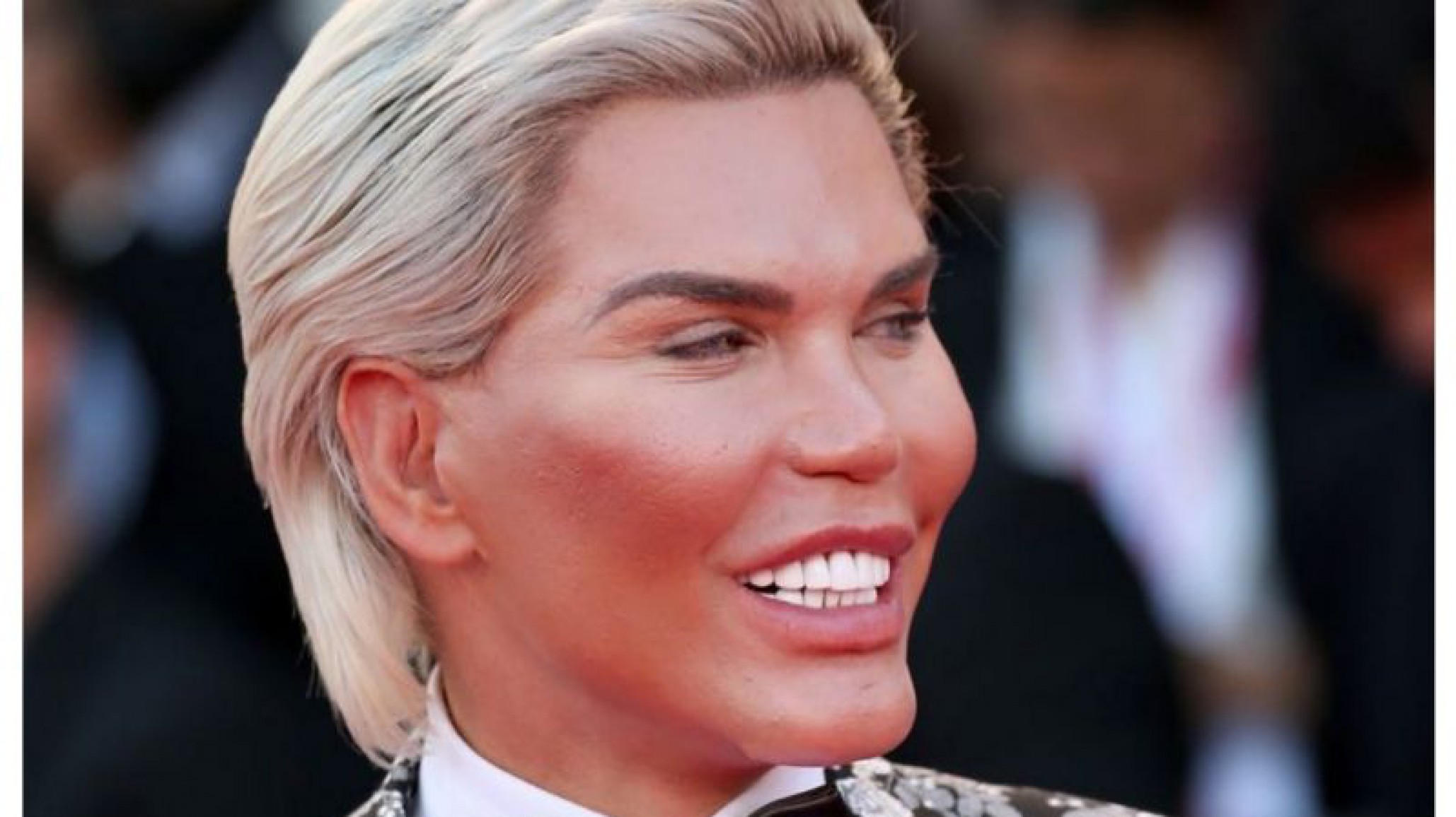 Invirtió millones para parecerse a Ken, ¡y ahora quiere ser Barbie!