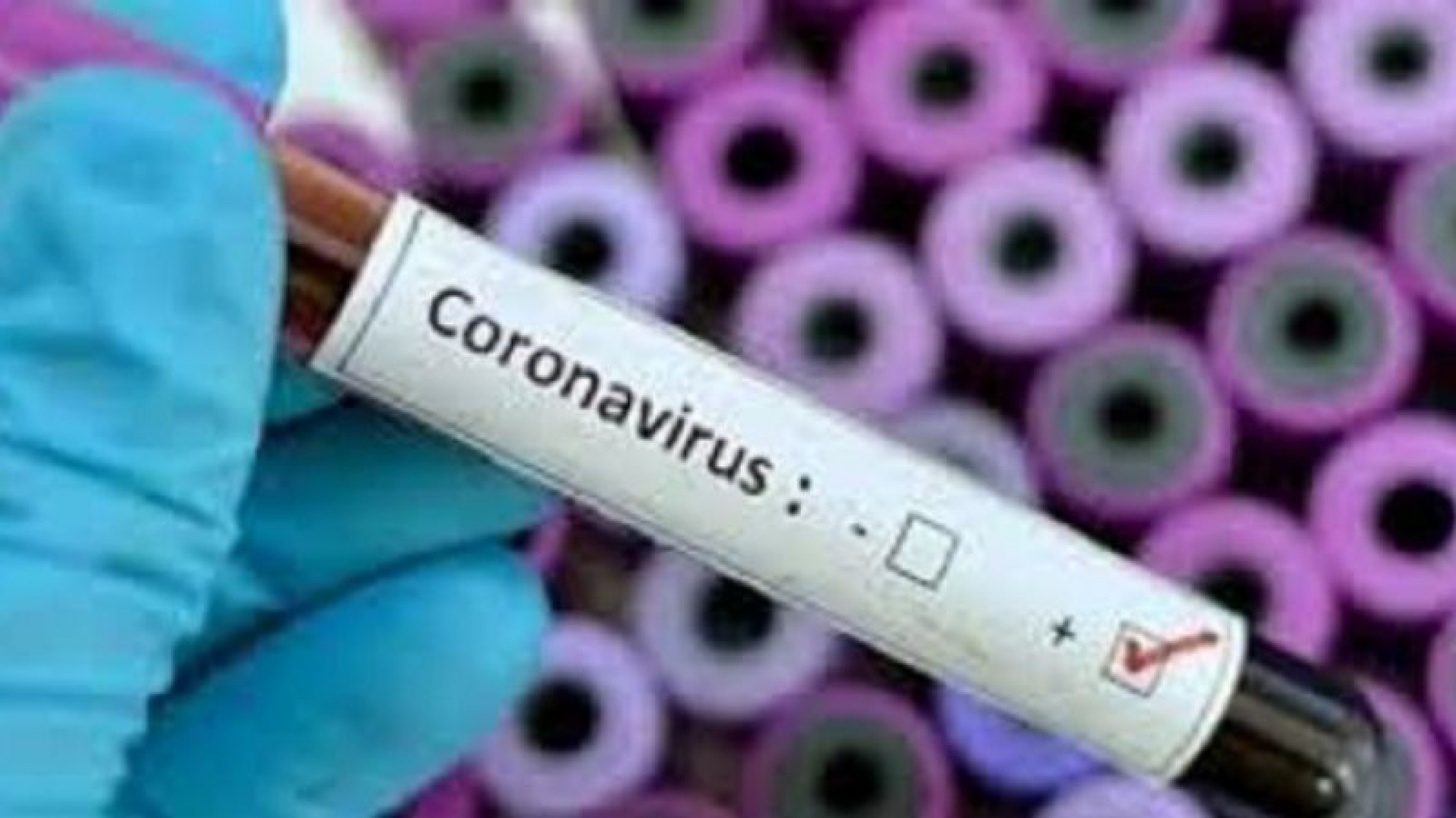 Descartaron Coronavirus en el comodorense fallecido, el resultado del test dio negativo