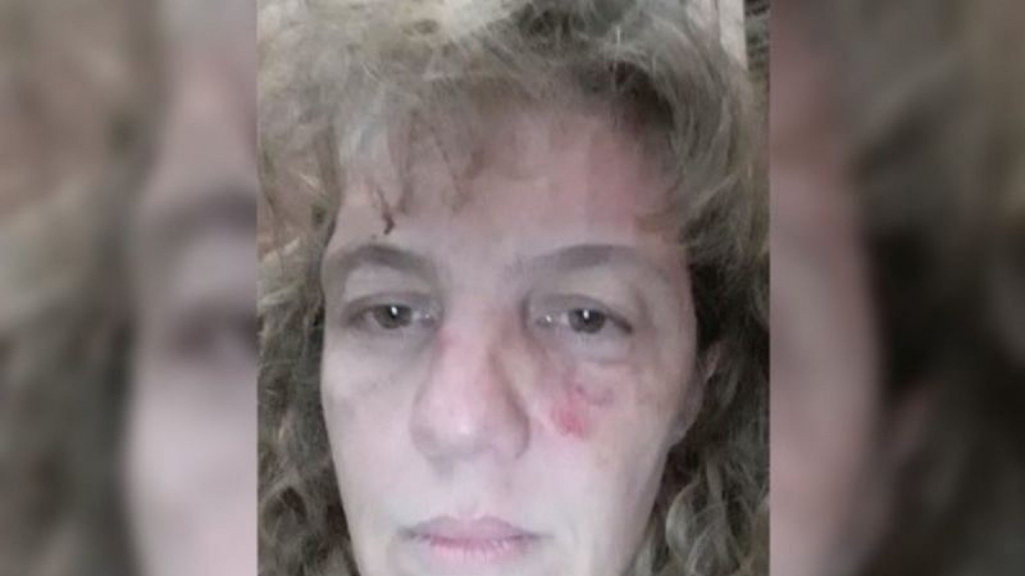 Indignante: Enfermera es golpeada y rociada con desinfectante por un vecino