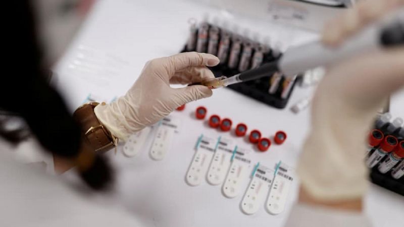 Coronavirus: la pérdida del olfato vinculada a su letalidad