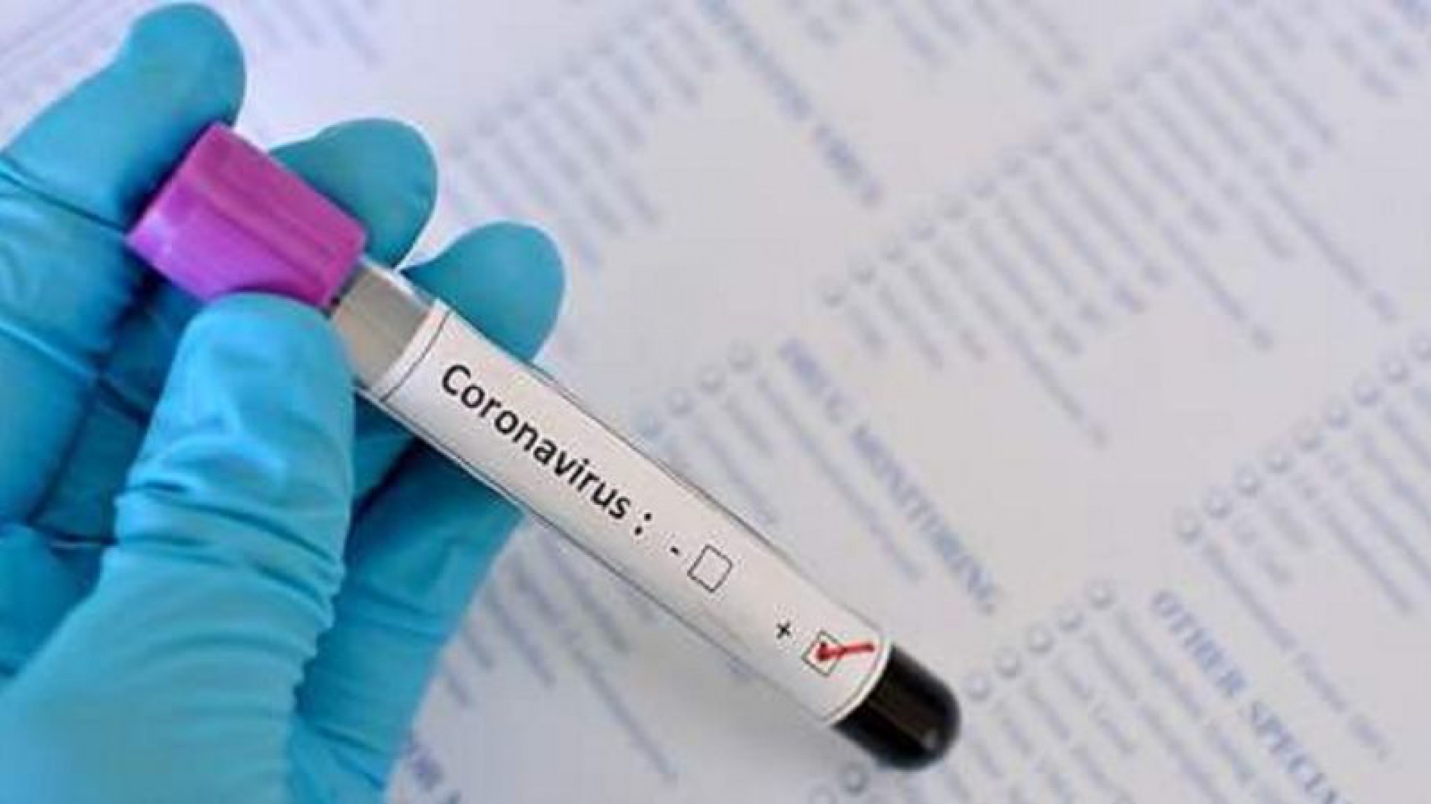 Coronavirus hoy: 7 muertes y 112 nuevos casos en Argentina