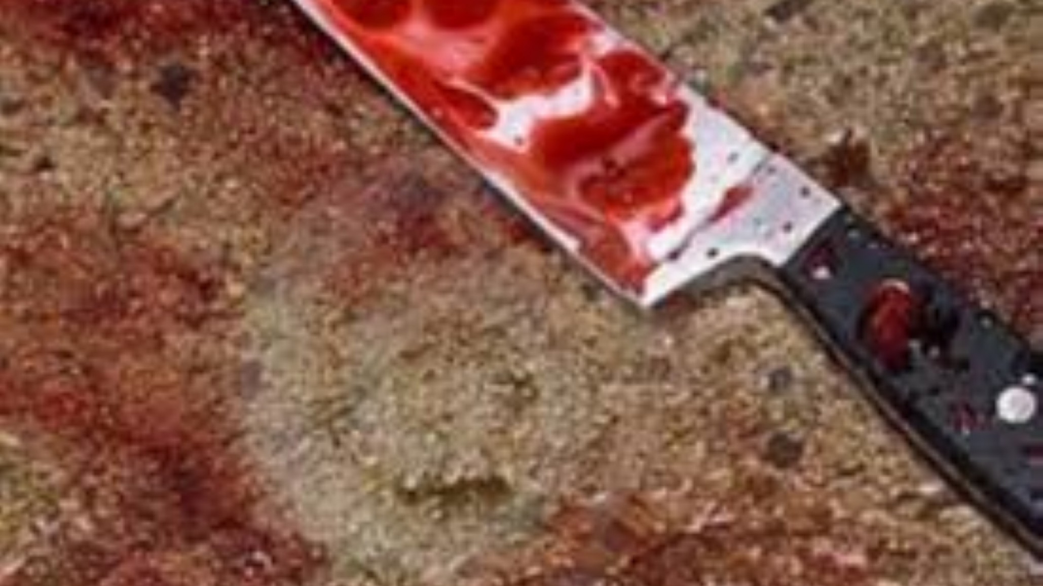 ¡Brutal! Con un cuchillo le desfiguraron la cara a una chica y debió recibir 25 puntos