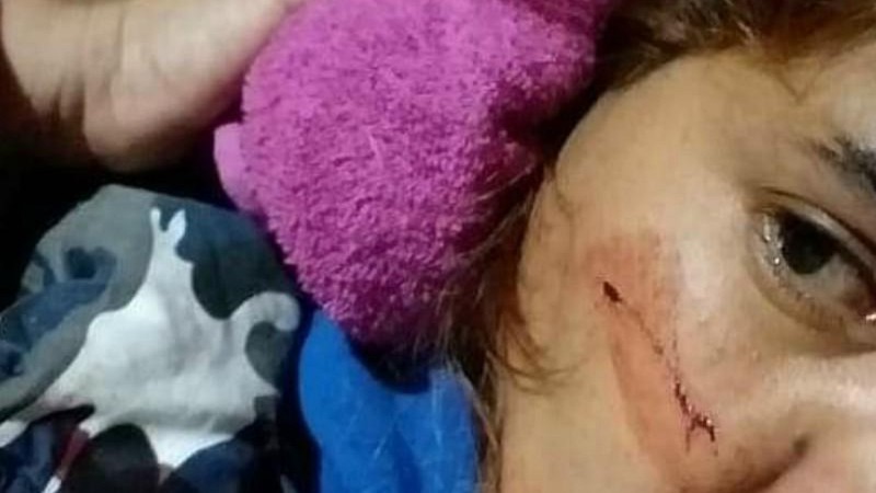 Se resistió a un robo y le dispararon en la cara: la bala sólo rozó su mejilla