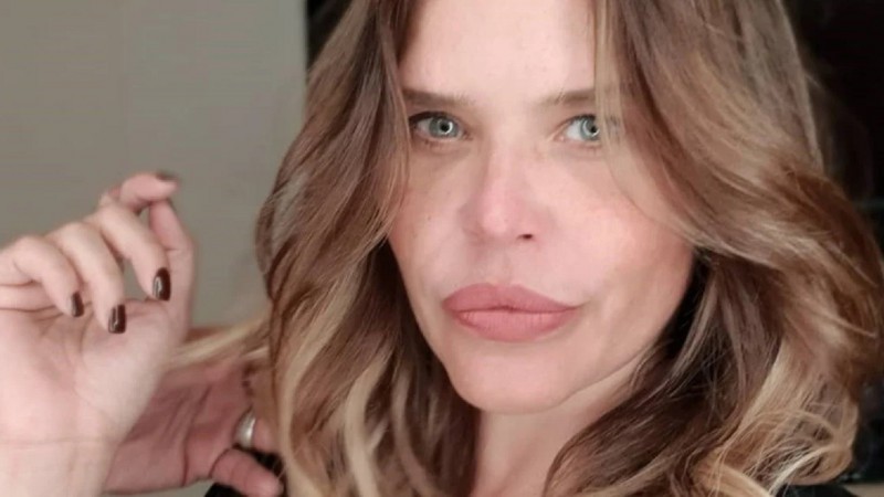 Nazarena Vélez muestra una de sus imperfecciones ¿Cuál?