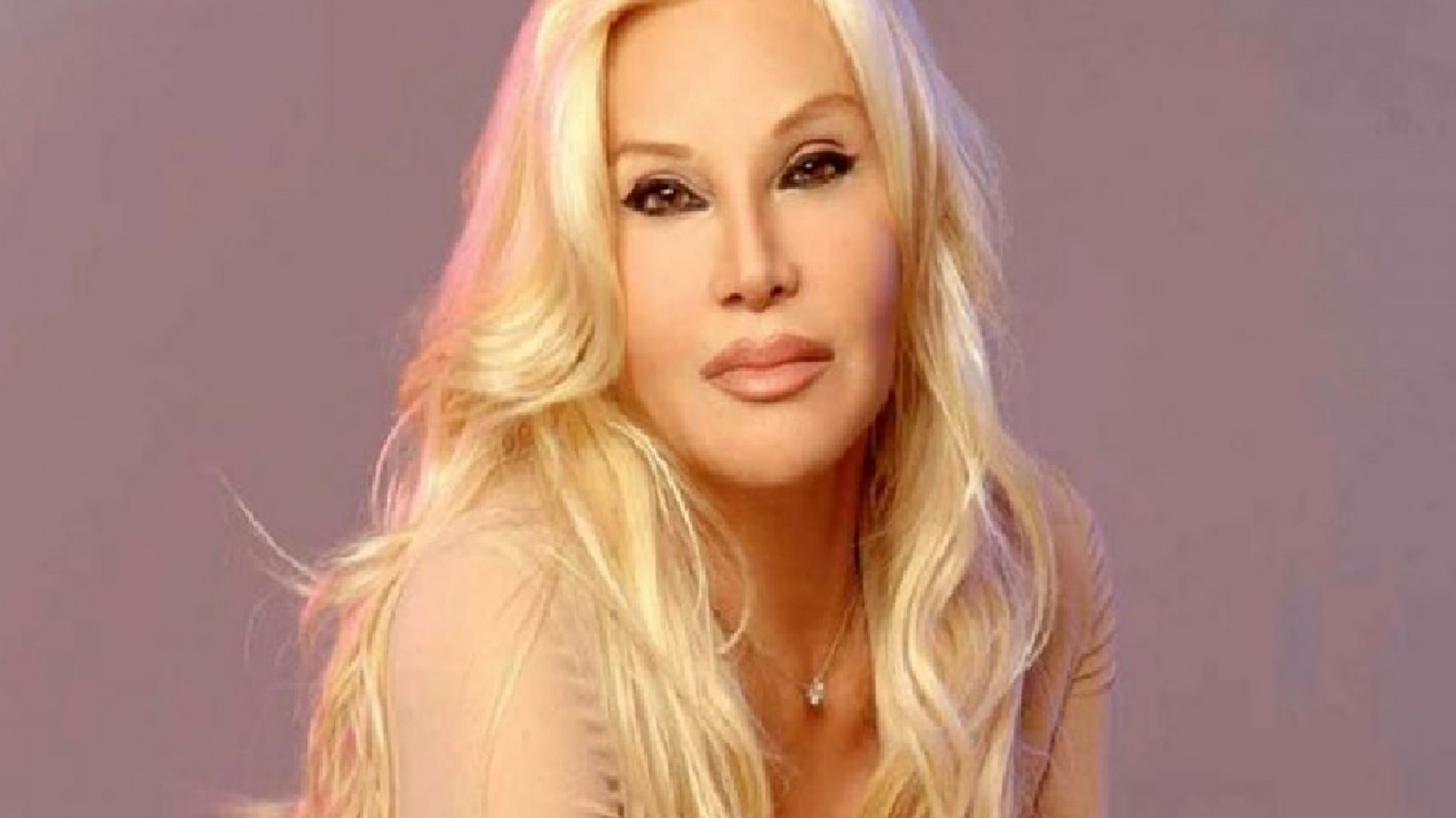 Susana Giménez se sacará el yeso y negó su pronto regreso a la Argentina