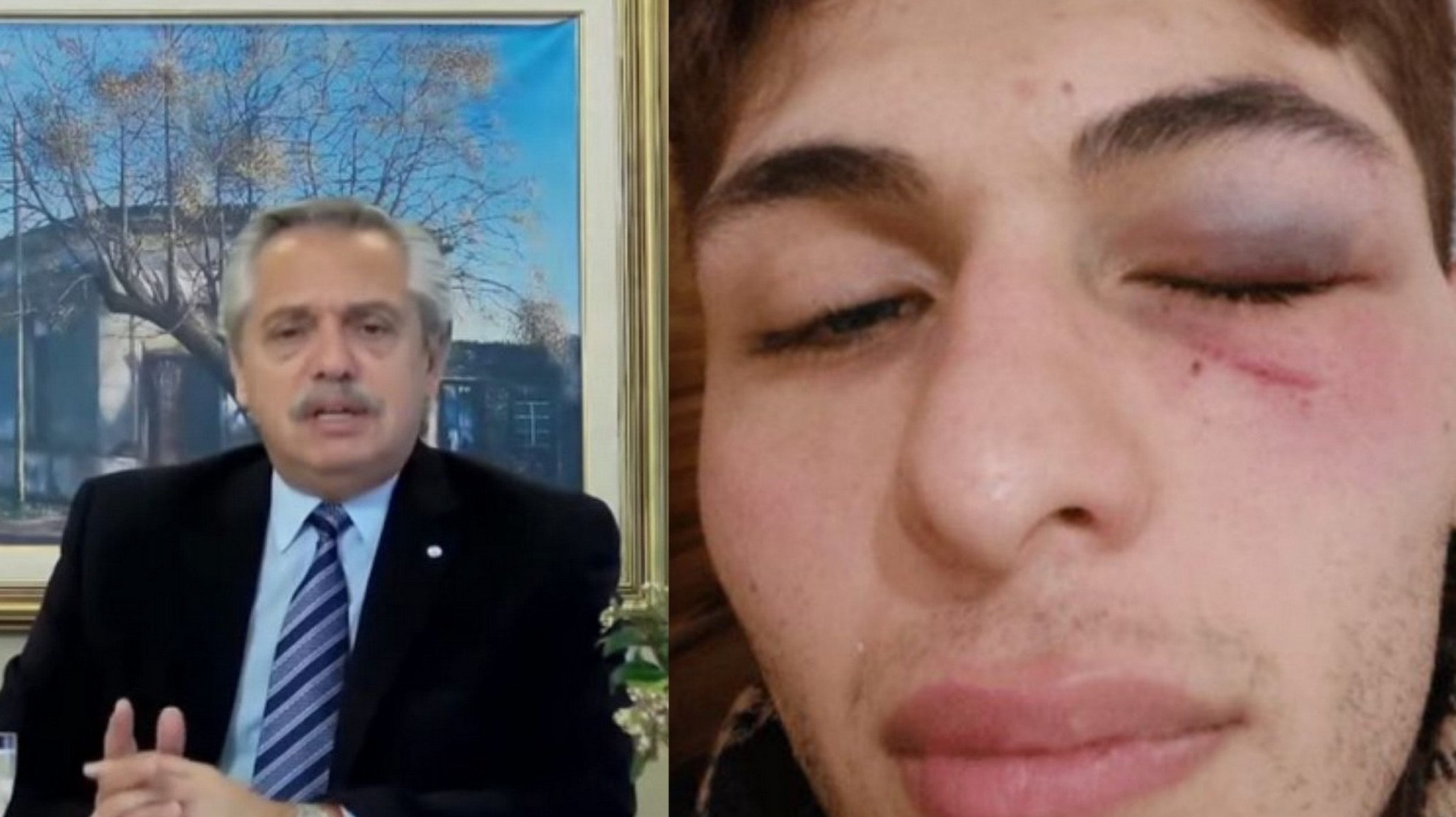 Alberto Fernández expresó su repudio al episodio de violencia “imperdonable” a joven no binario