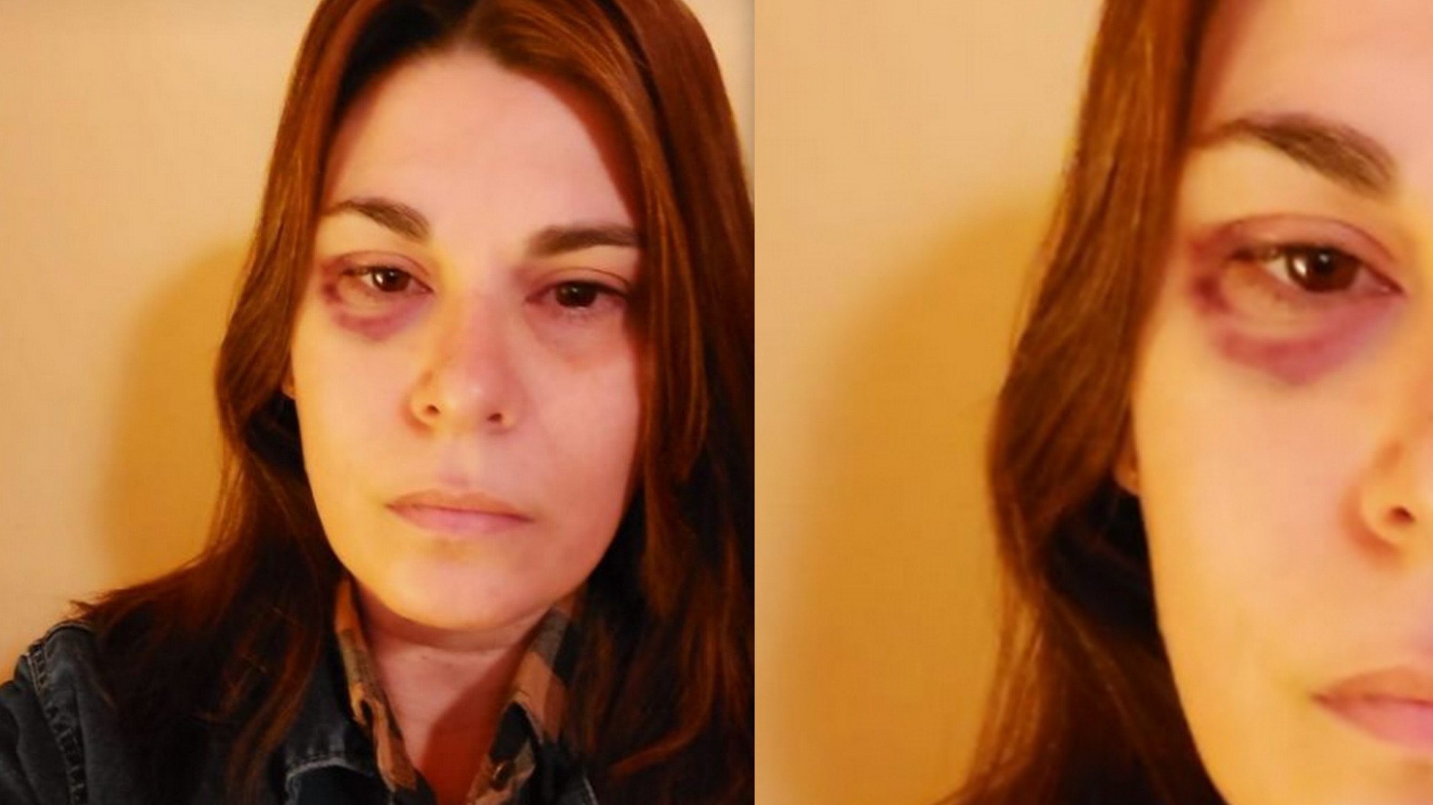 Vicedirectora agredida por una madre: “ya no puedo más”