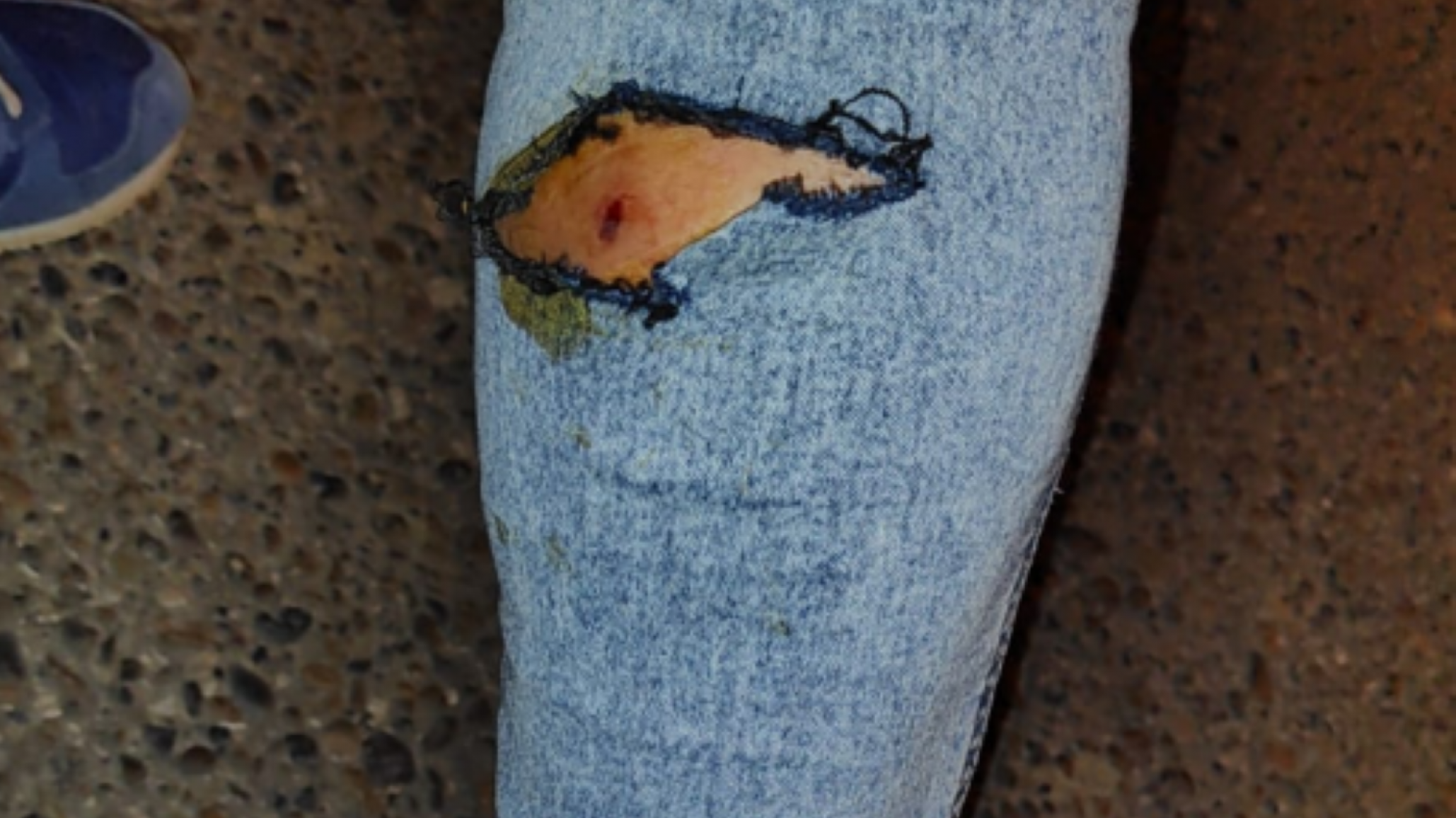 Tres perros “se abalanzaron sobre una mujer” y terminó en el hospital