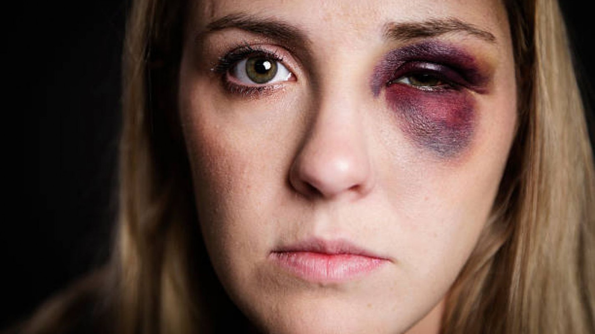 Mujer pidió auxilio, su pareja la golpeó en el rostro y no la dejaba salir de su casa