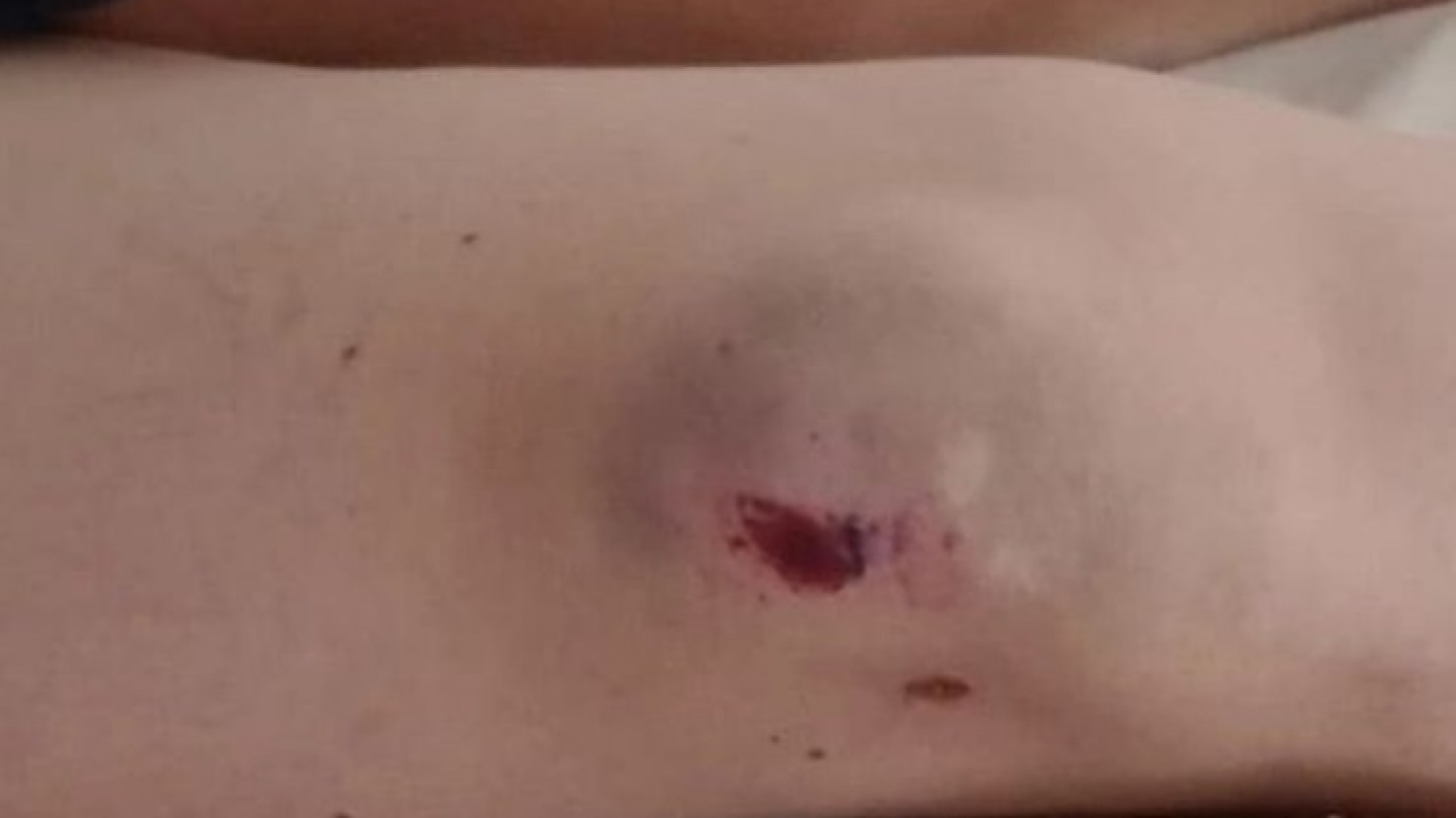 San Cayetano: Una mujer fue asaltada en plena vía pública cuando iba al médico