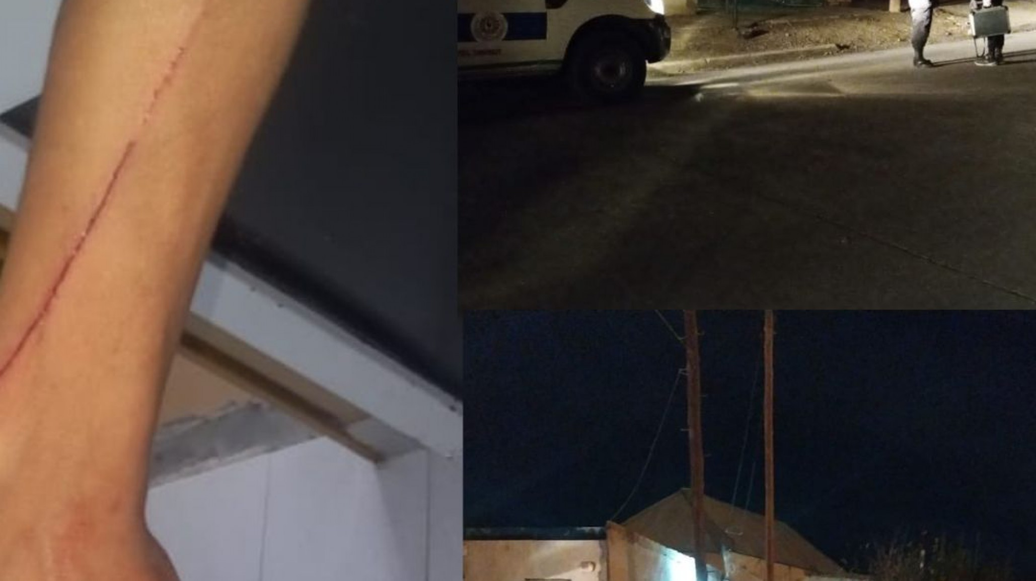 Sobrino hirió con un arma blanca a su tío durante una reunión familiar