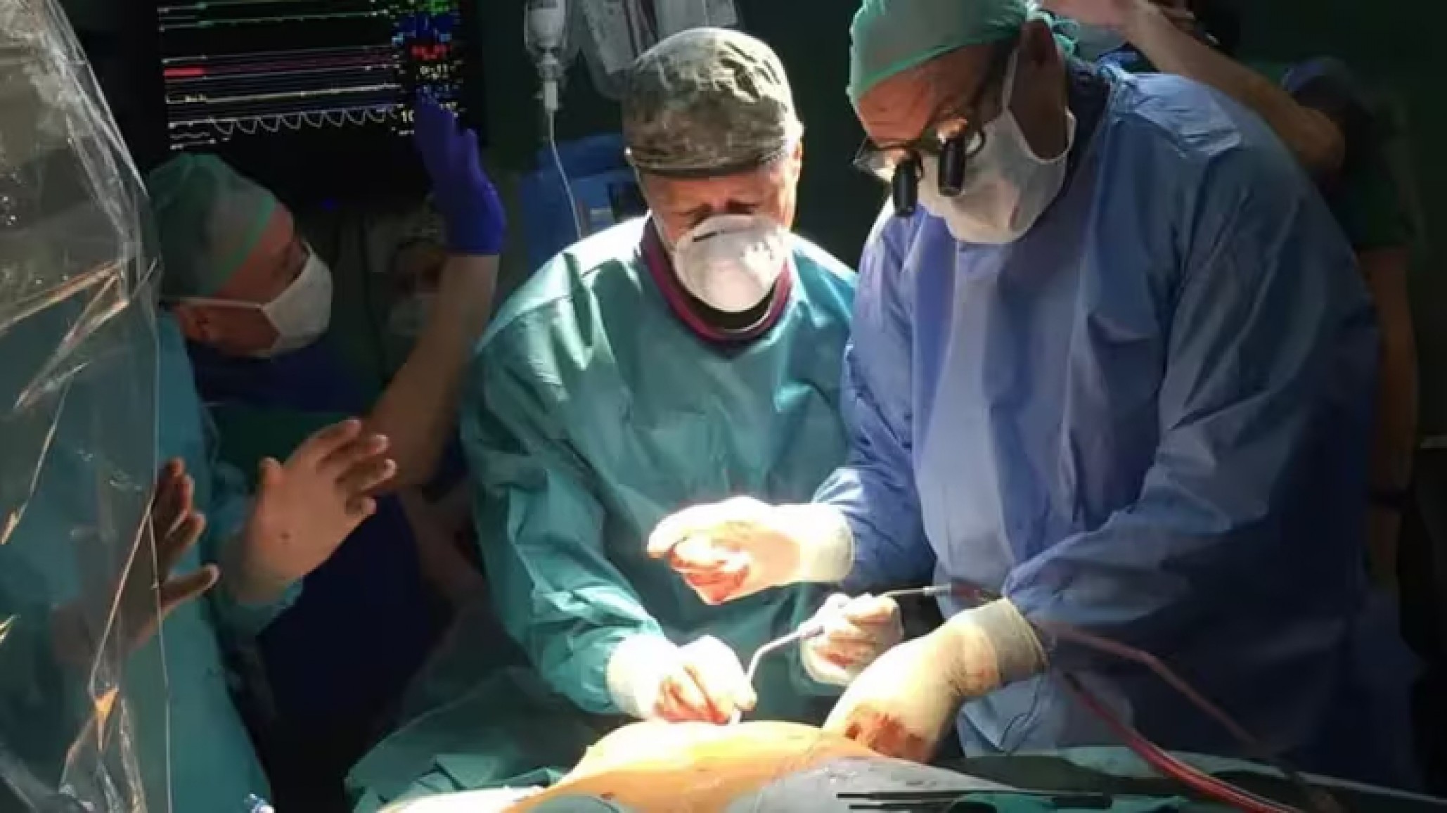 Federico Benetti: El medico argentino reconocido como uno de los siete sabios de la cirugía cardiovascular