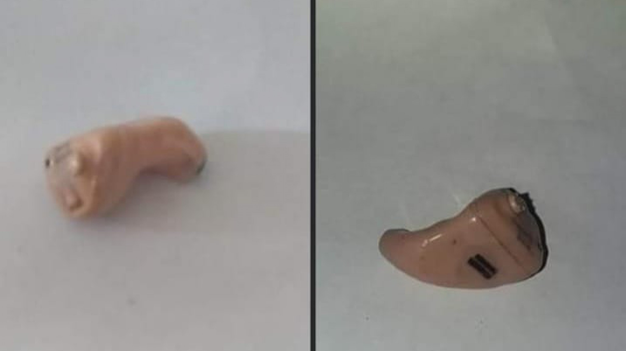 Pedido de solidaridad: una vecina con otoesclerosis necesita audífonos para poder trabajar