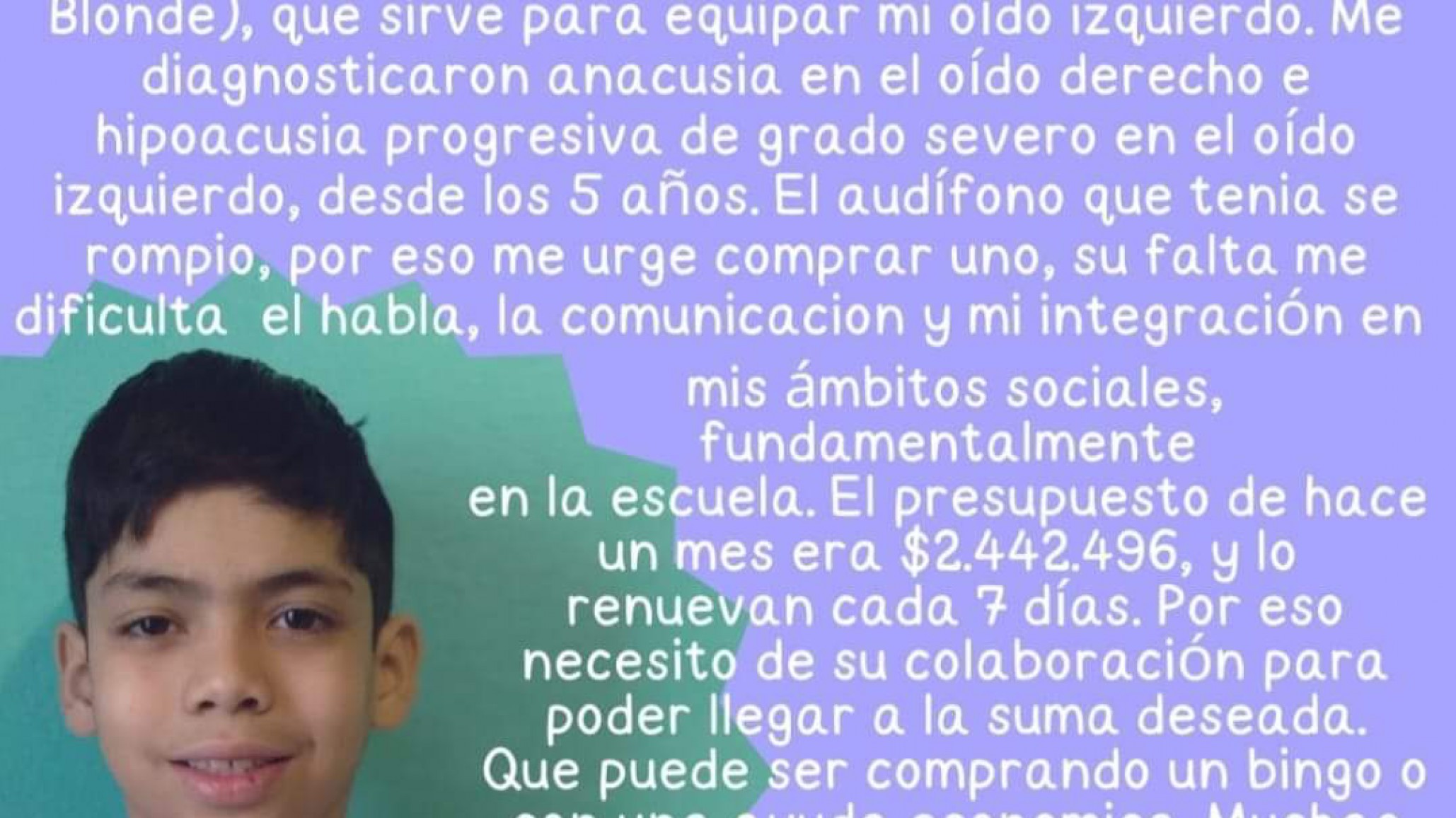 Campaña solidaria: "Camilo tiene anacusia en su oído derecho e hipoacusia en su oído izquierdo"