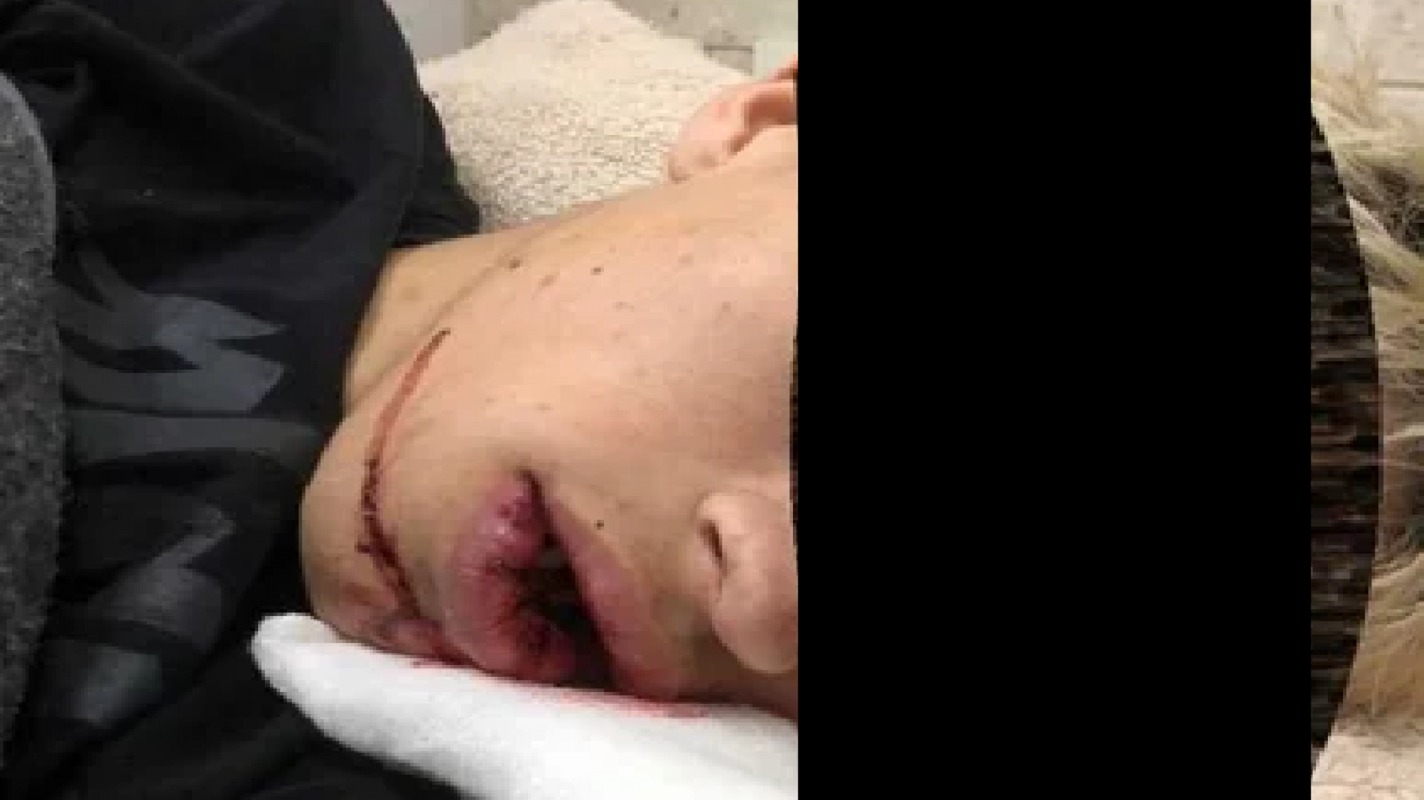 Salvaje golpiza a un joven de 19 años a la salida de un boliche: "Le bajaron todos los dientes"