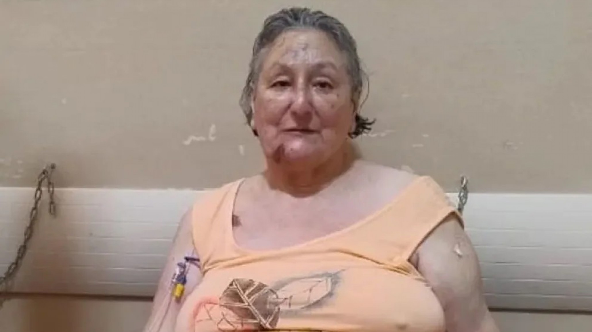 Murió la única sobreviviente del derrumbe en Villa Gesell