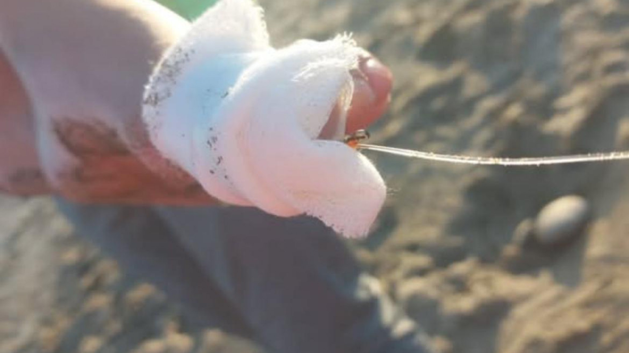 Un nene de 8 años terminó herido tras clavarse un anzuelo en Playa Unión