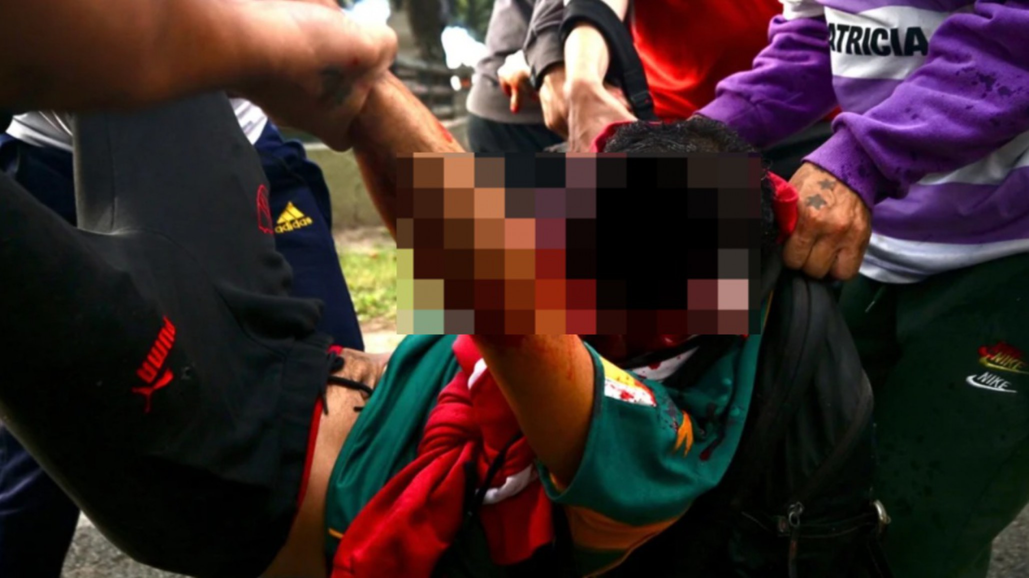 Pablo Grillo sigue en terapia intensiva tras la represión policial en la marcha de jubilados