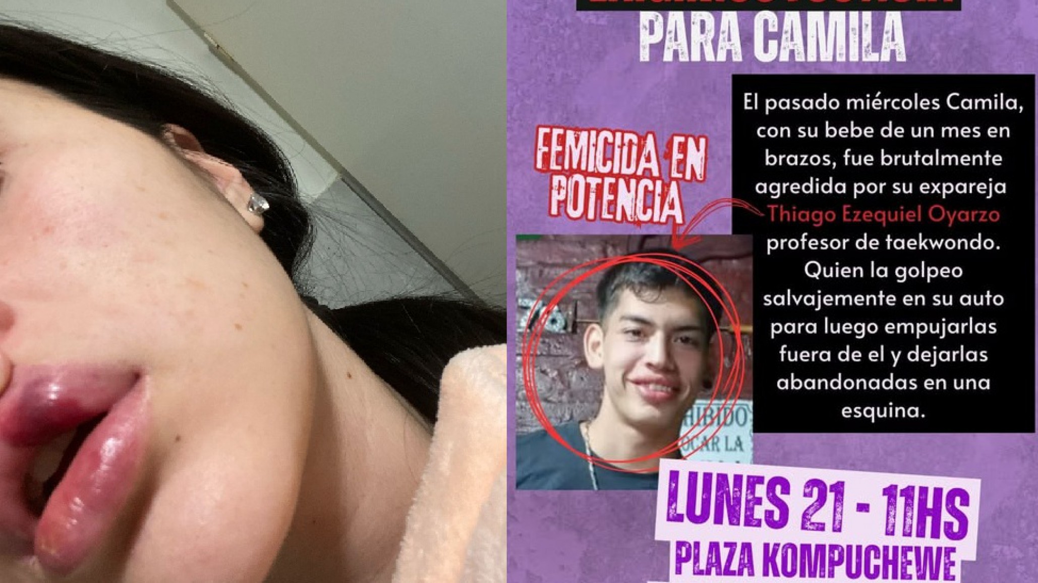 Convocan a una marcha en reclamo de justicia por la joven madre agredida por su ex pareja en Km.8