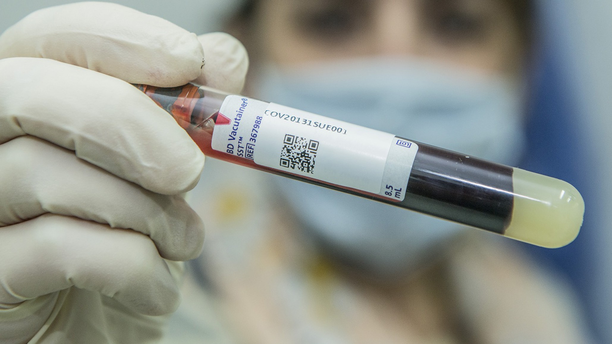 Tres adultos acusados de abusar de un adolescente de 14 años que contrajo VIH y sífilis