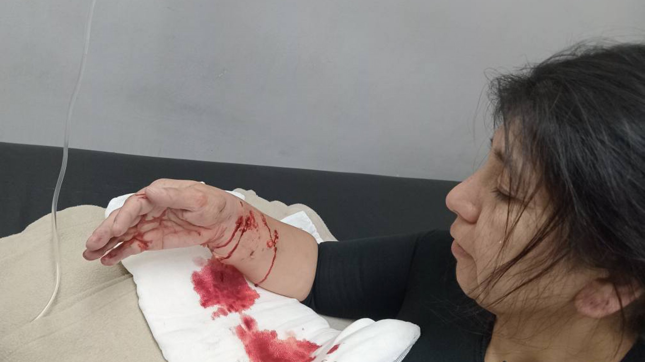 Brutal ataque de un pitbull a una mujer que salió a entrenar: "Tiene el brazo destruido"