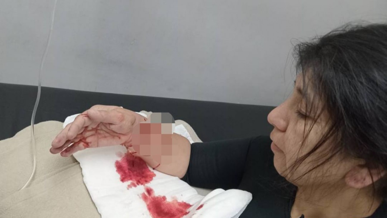 Viviana Velásquez, la atleta atacada por un pitbull que ya había mordido a un pescador, deberá someterse a una nueva cirugía