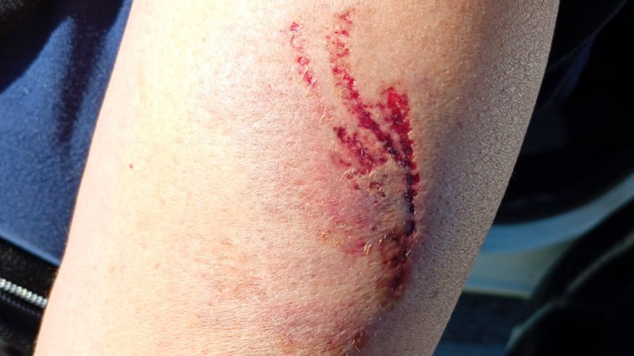 Comodoro: Hospitalizaron a una mujer tras ser atacada por una jauría de perros