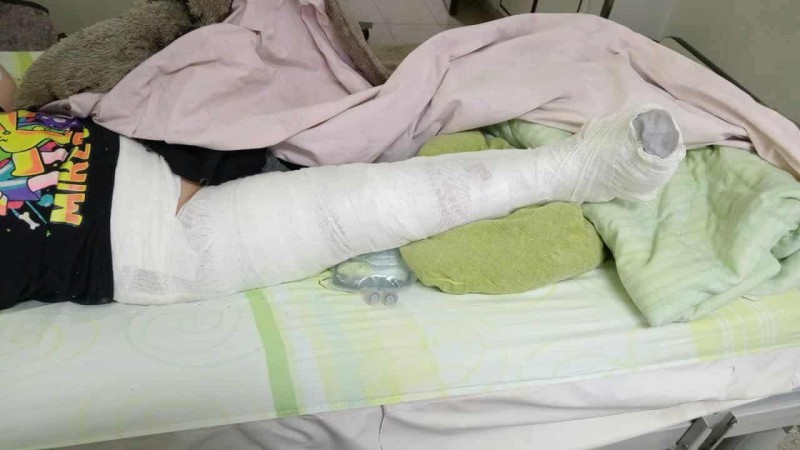 Un niño de 6 años cayó de un muro sin baranda en el barrio Pietrobelli