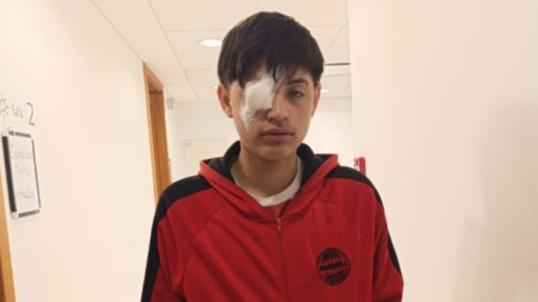 Operaron exitosamente a Thomas tras un accidente ocular y su evolución es favorable