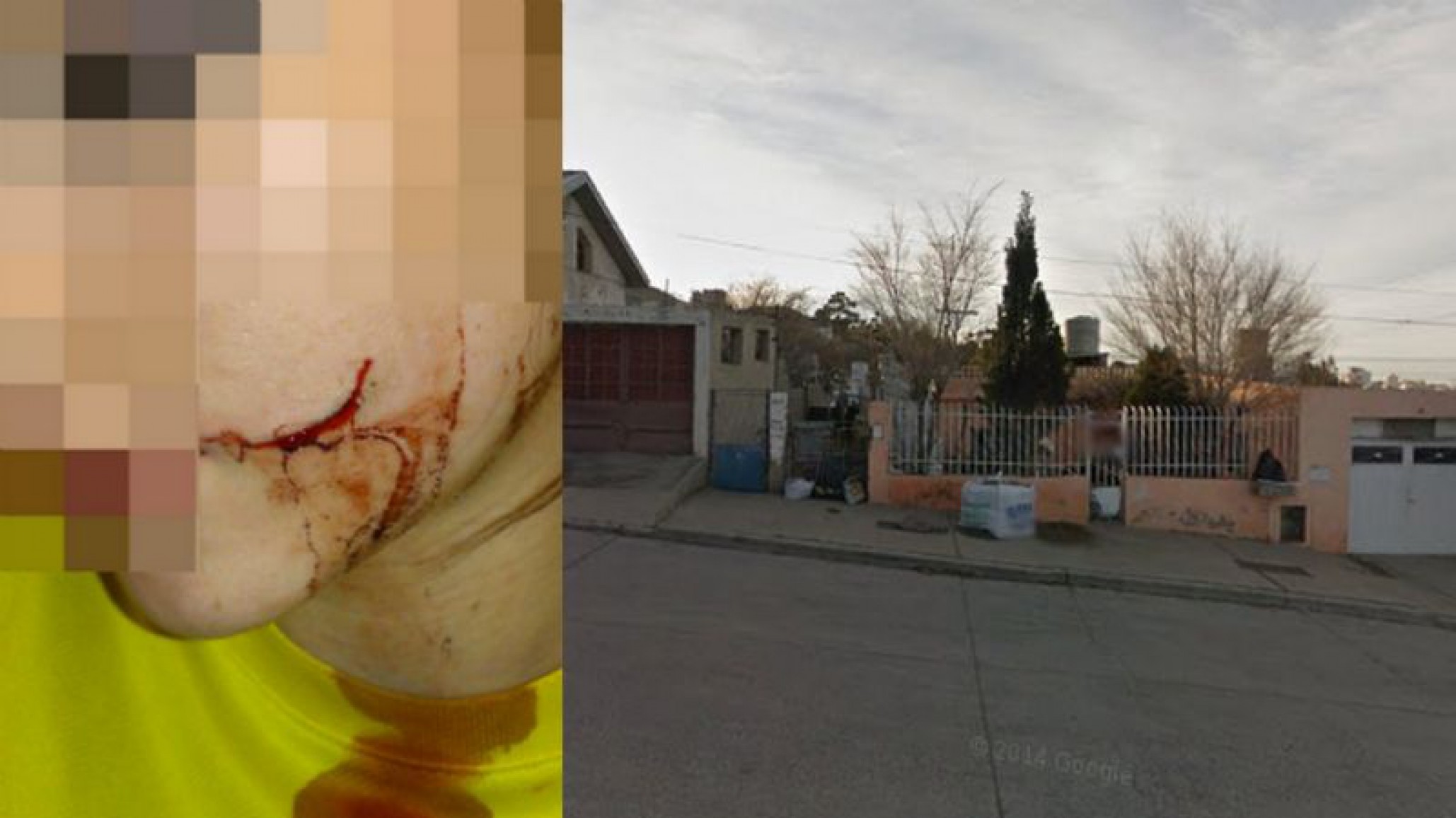 Un chofer de taxi fue robado y herido en el rostro con un arma blanca