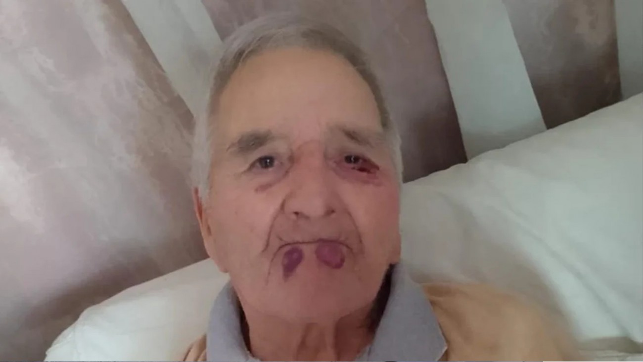 Escándalo en un geriátrico de Mar del Plata: Golpearon brutalmente a a un jubilado y fue hospitalizado