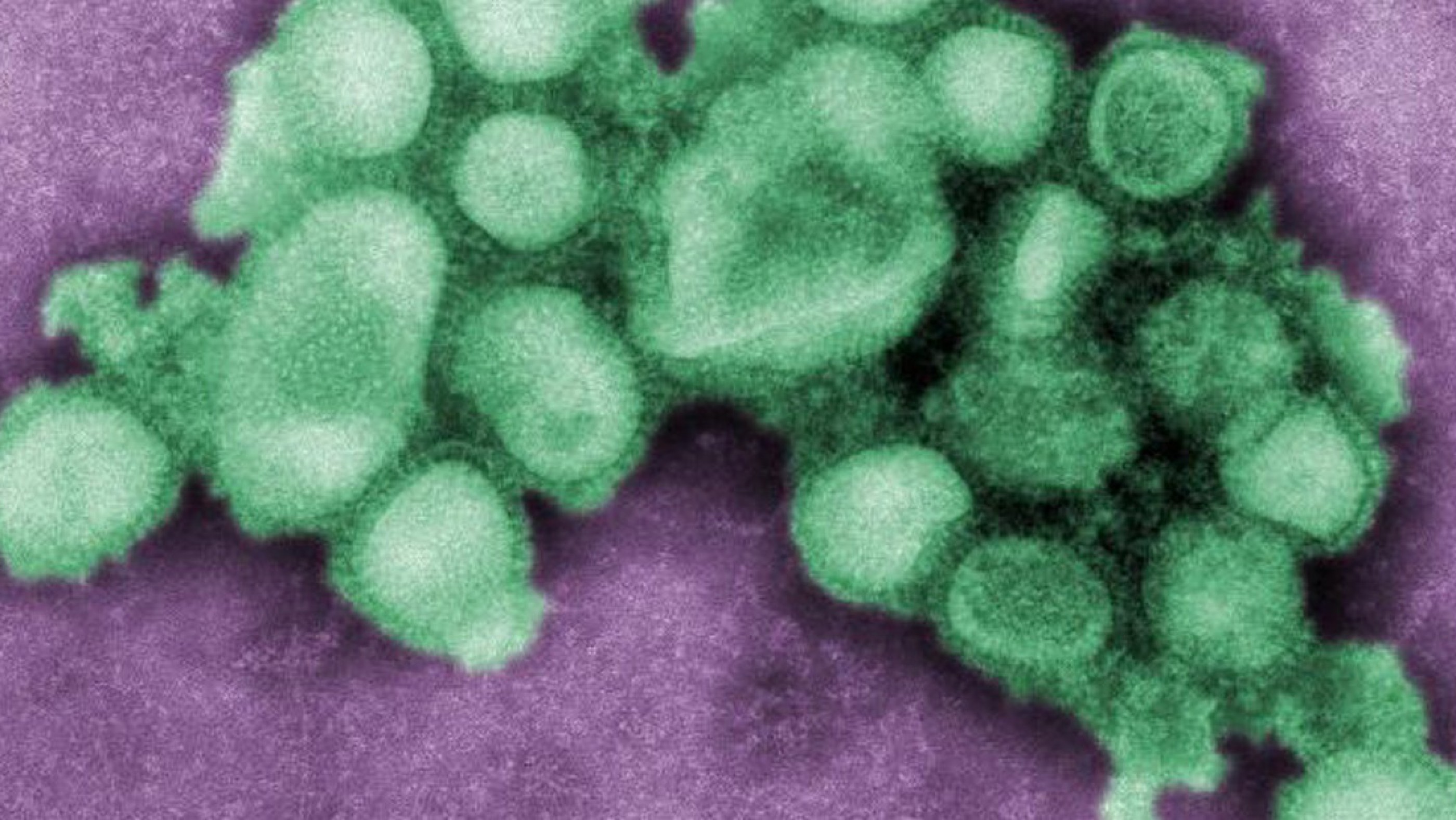 La variante "K" de influenza A llegó a Buenos Aires y Santa Cruz