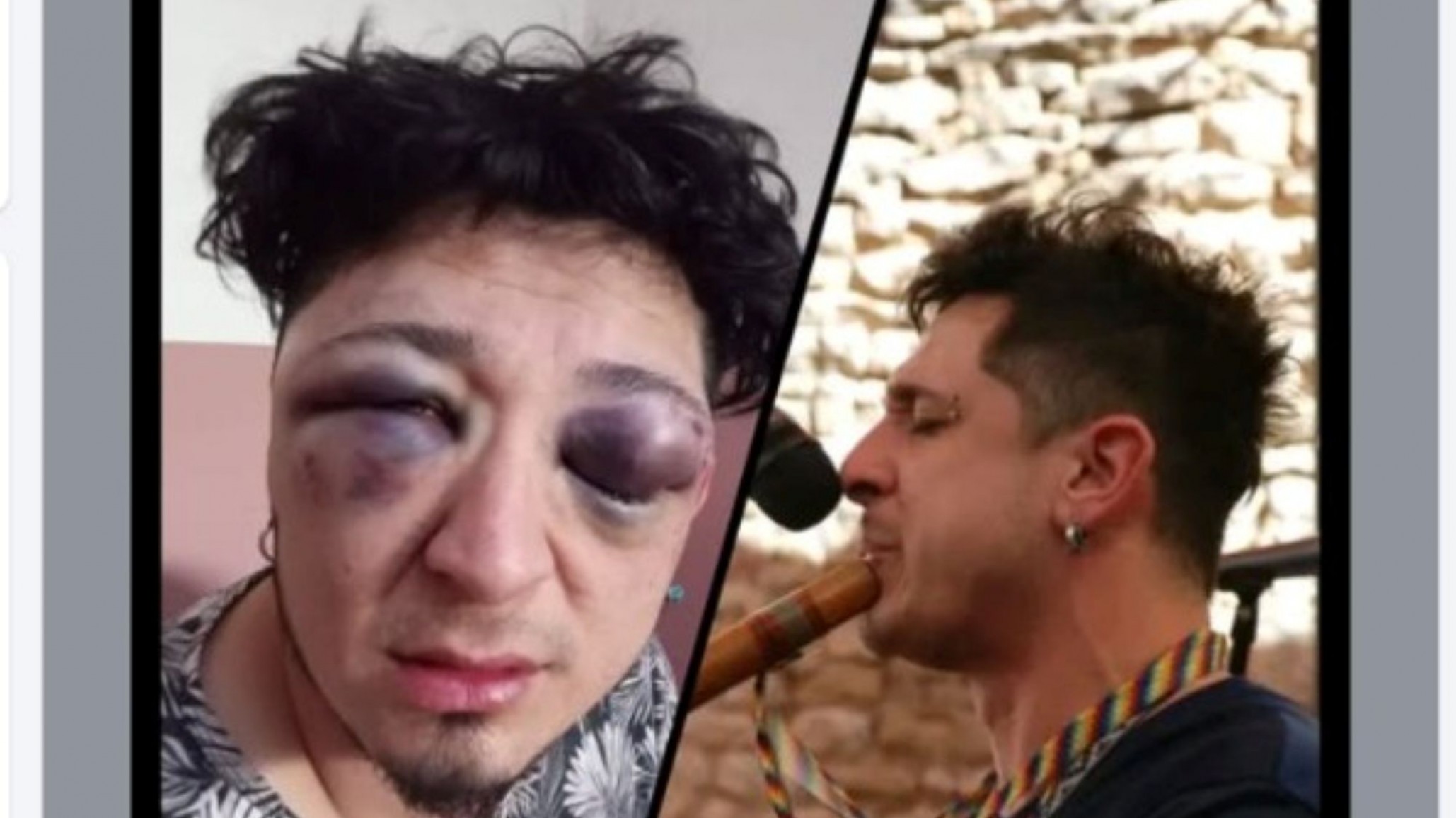 Ariel Carrizo volvió a pedir justicia y denunció que vive con miedo tras la brutal golpiza en Pico Truncado