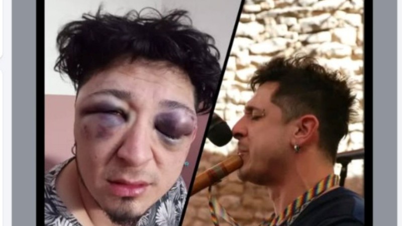 Ariel Carrizo volvió a pedir justicia y denunció que vive con miedo tras la brutal golpiza en Pico Truncado