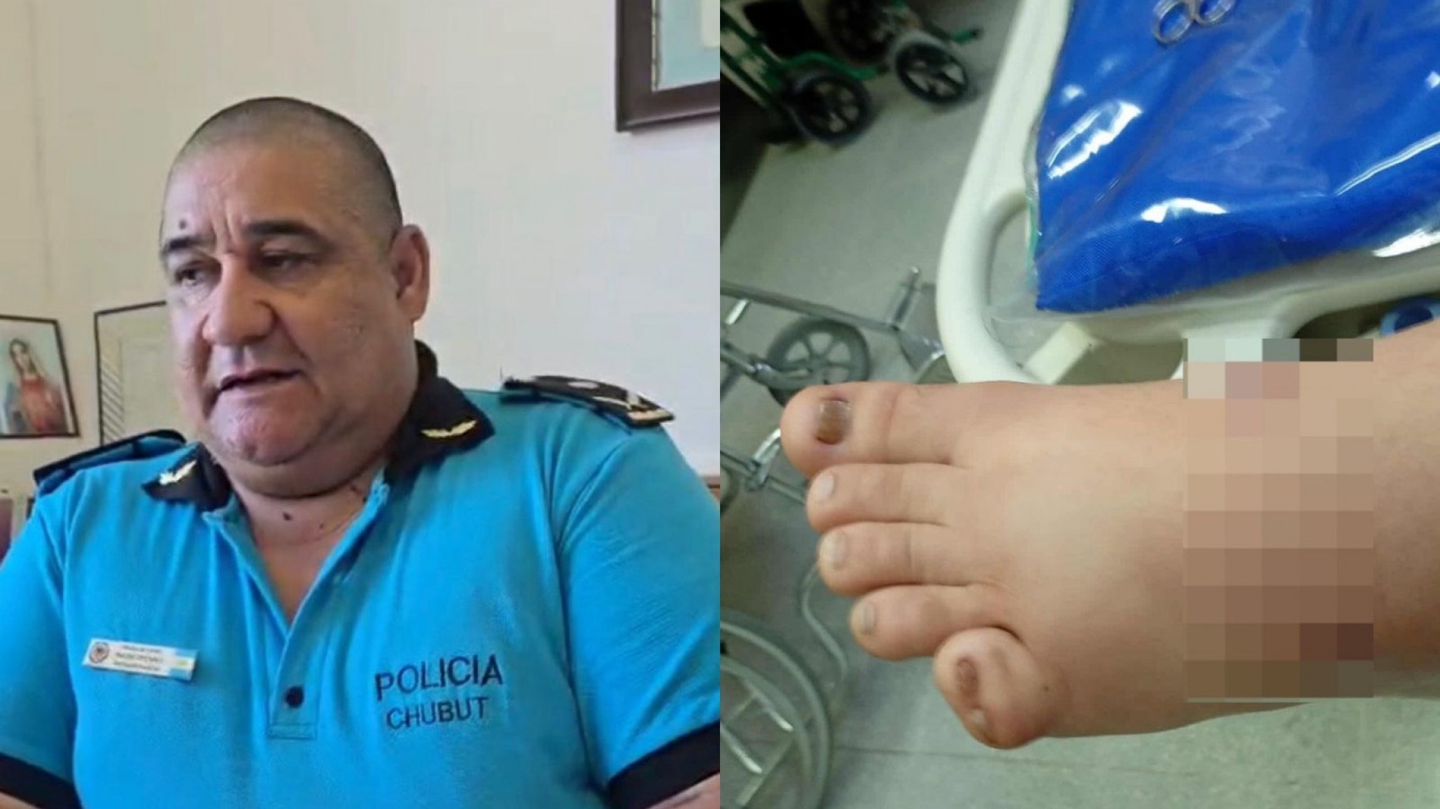 "Descendió del vehículo y le disparó sin mediar palabra": menor herido tras un cumpleaños de 15