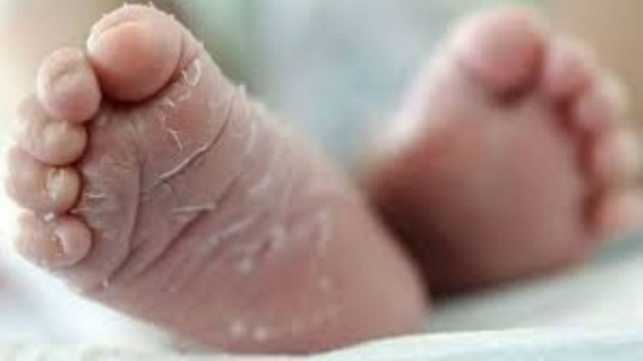 Un bebé de 20 días se encuentra en estado crítico, tiene signos de maltrato