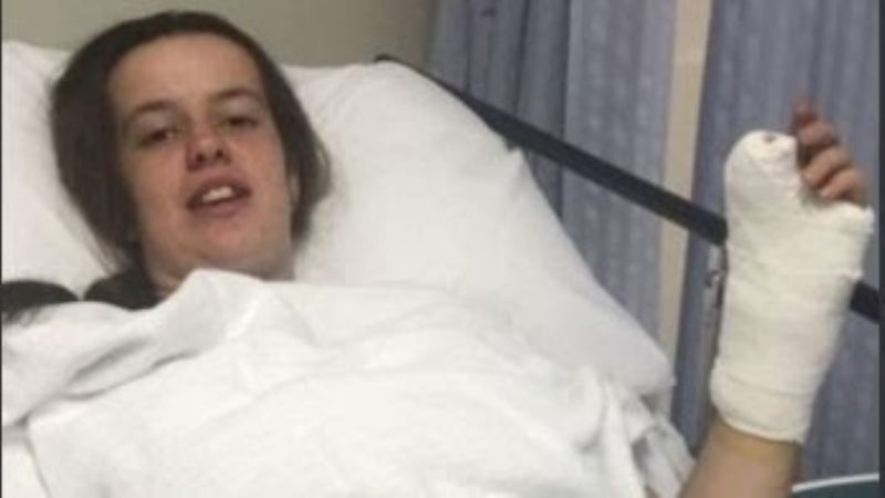 Increíble: se equivocaron y le implantaron el dedo del pie en su mano