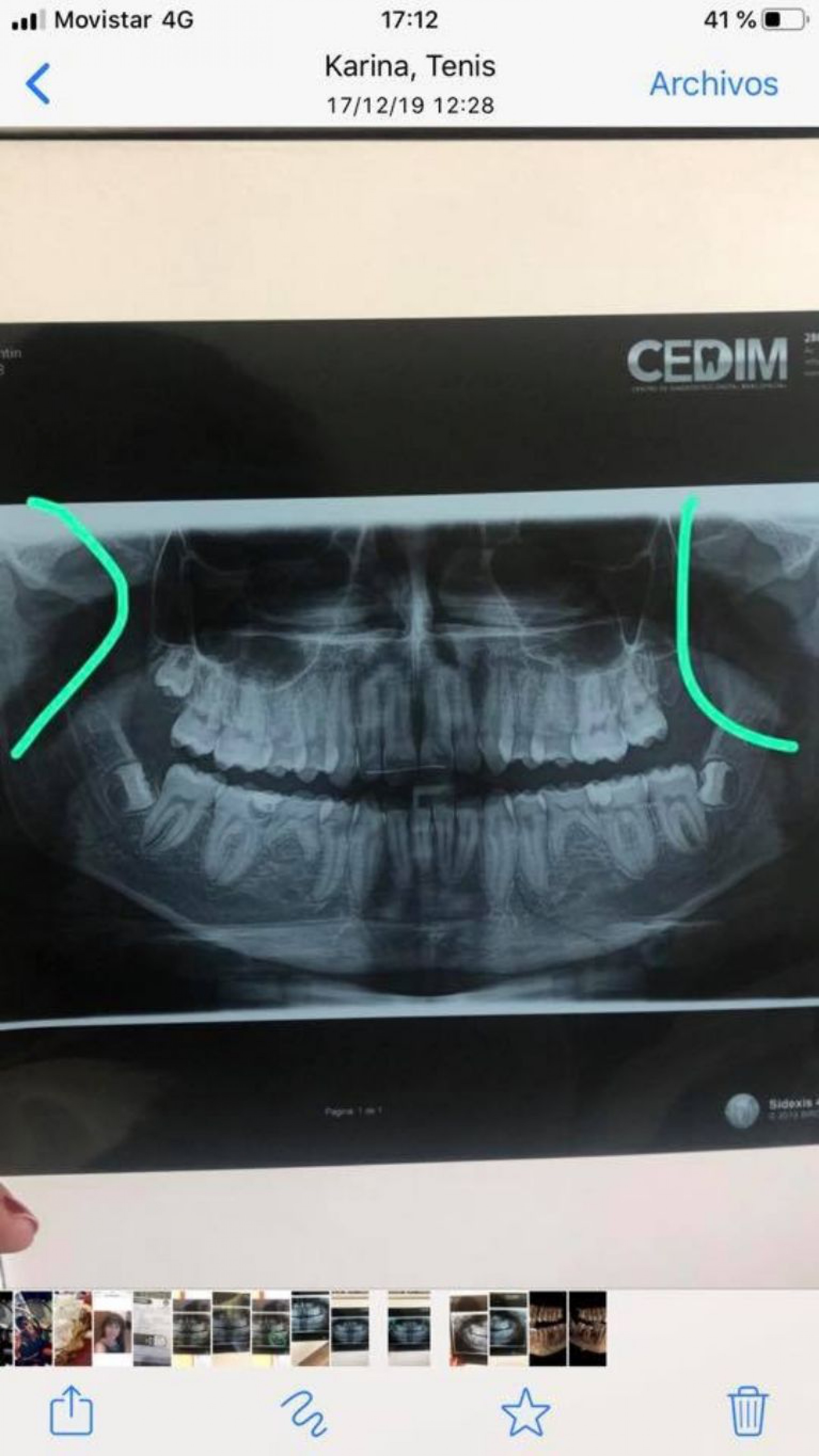 Madre denunció que un jugador de rugby le rompió la mandíbula a su hijo: ”Desesperante y traumático”