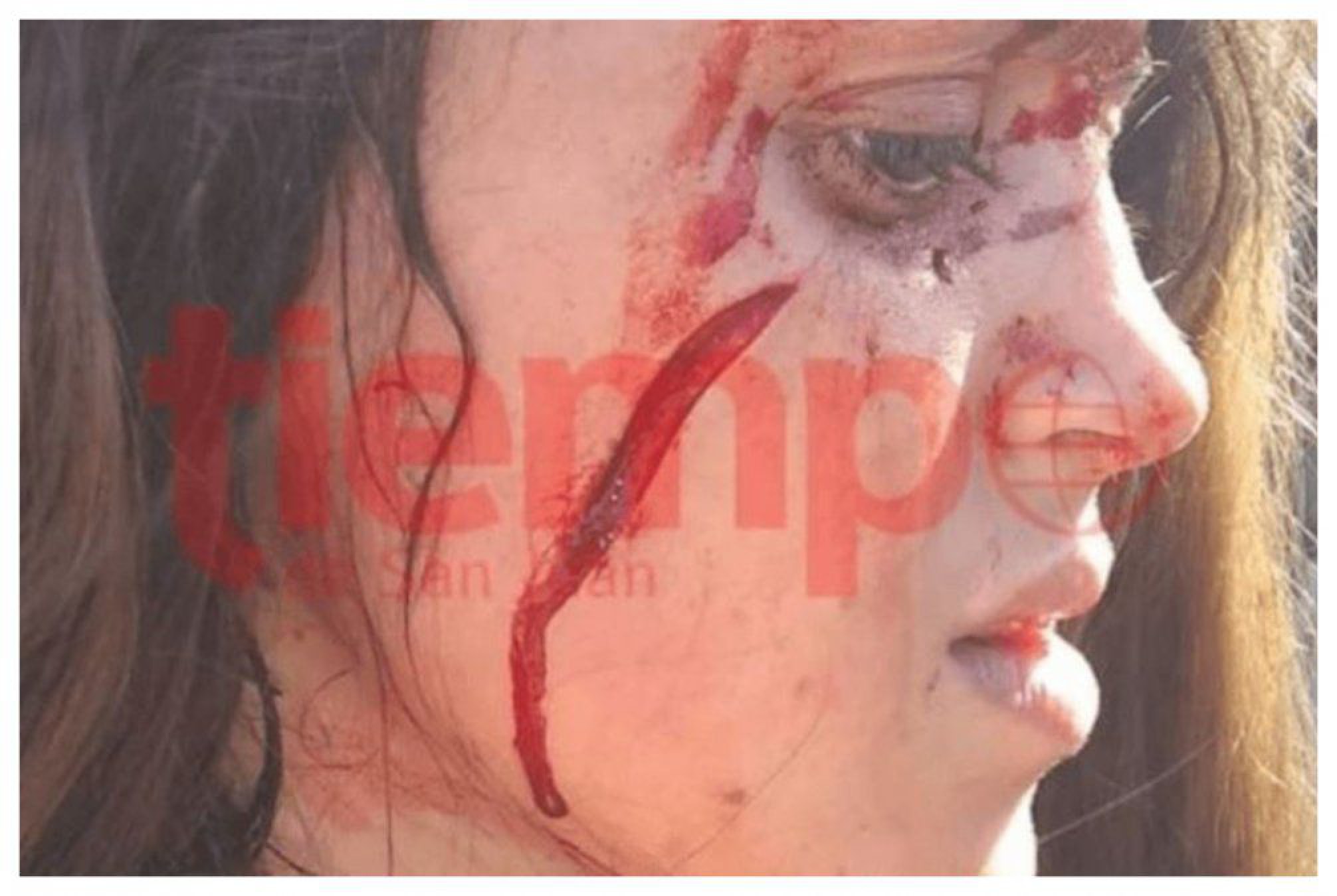 ¡Brutal! Con un cuchillo le desfiguraron la cara a una chica y debió recibir 25 puntos