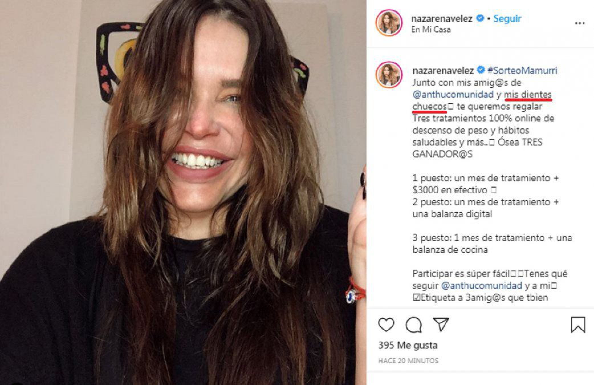 Nazarena Vélez muestra una de sus imperfecciones ¿Cuál?