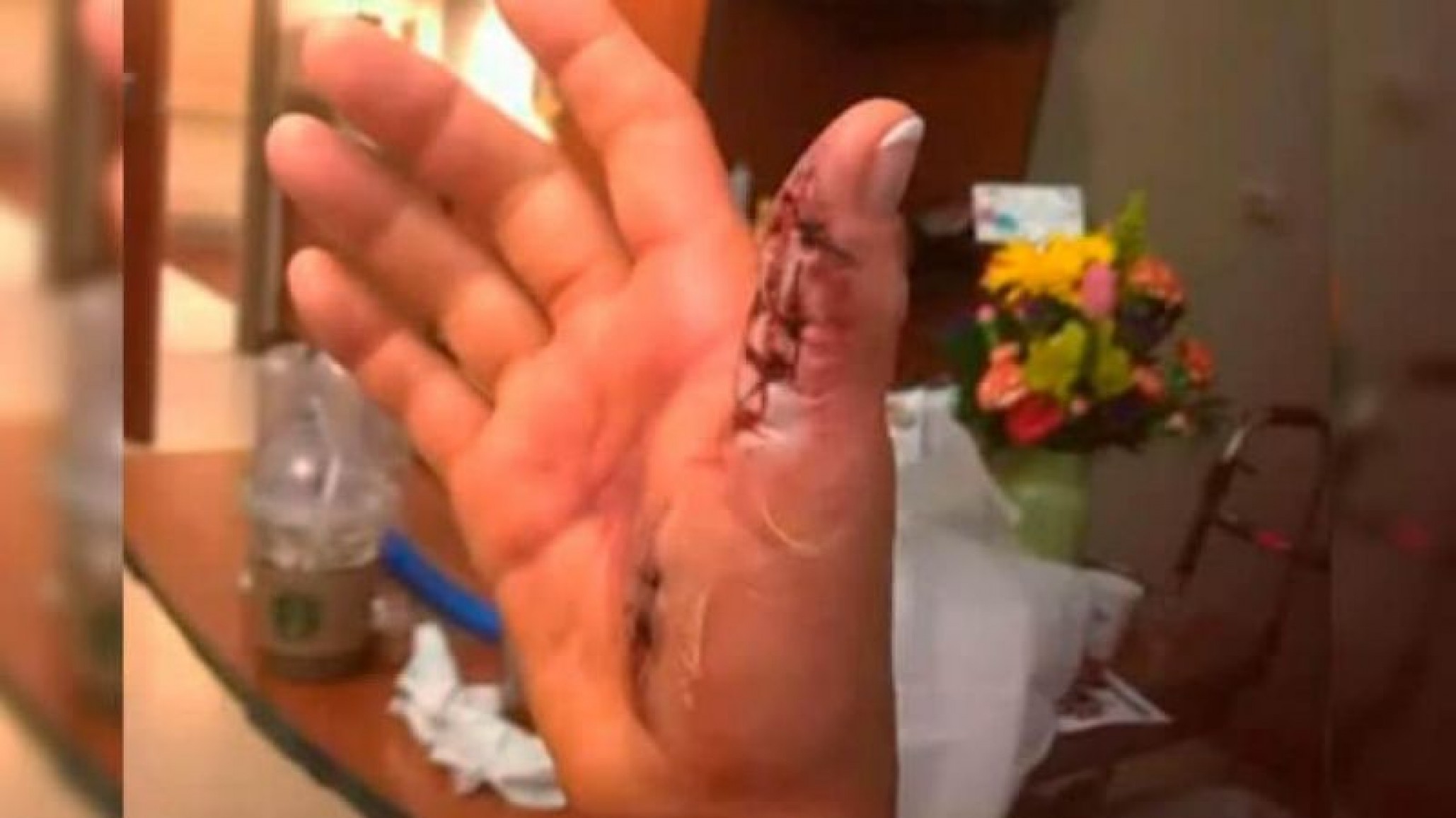 Fue por un tratamiento de belleza y casi pierde la mano