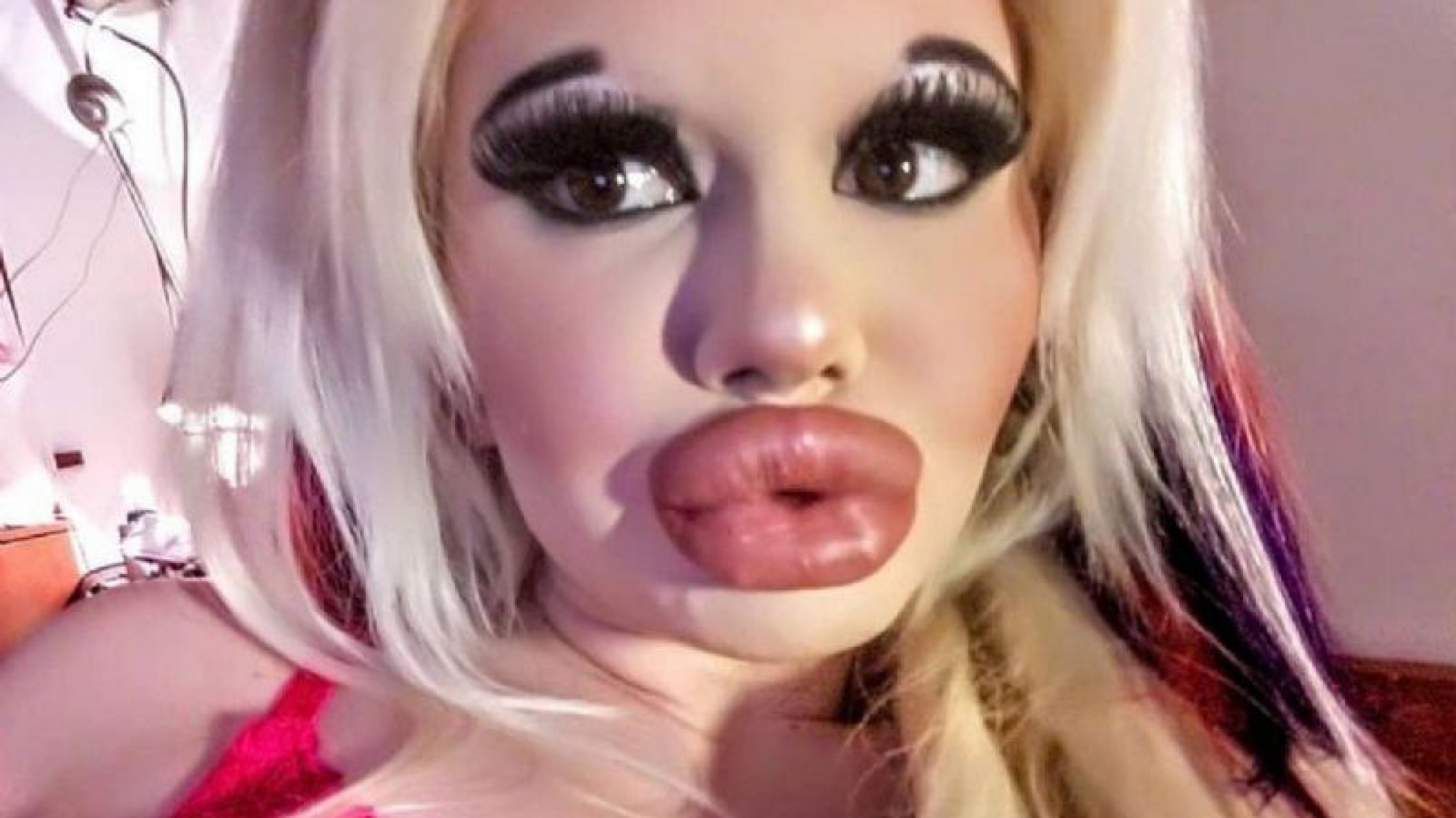 Besame, besame, besame: Conocé a la mujer que quiere tener los labios más grandes del mundo