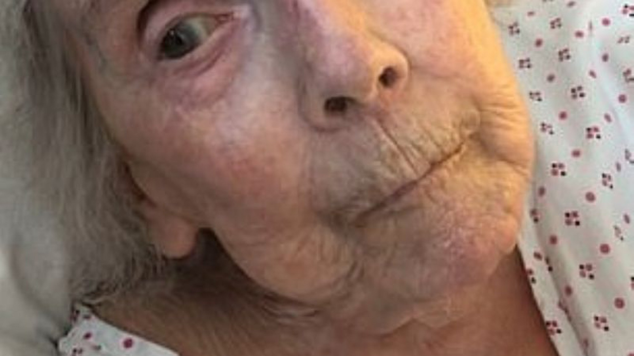 Brutal ataque a veterana de guerra en hogar de ancianos