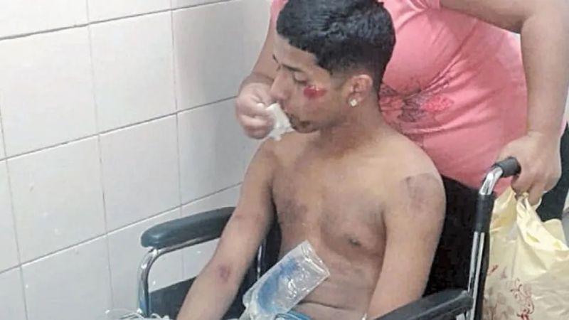 Patovicas de un boliche le dieron una paliza a un joven: lo desfiguraron