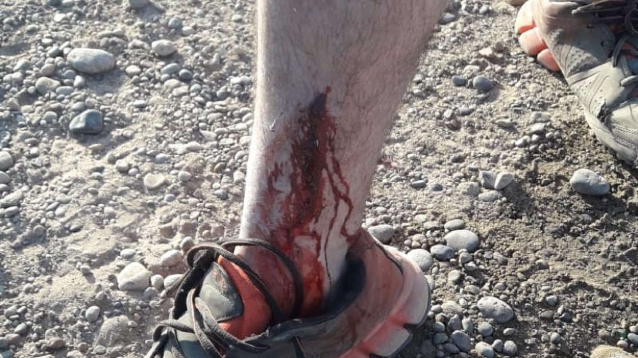 Fueron a un recital en Trelew y terminaron lastimando a policías