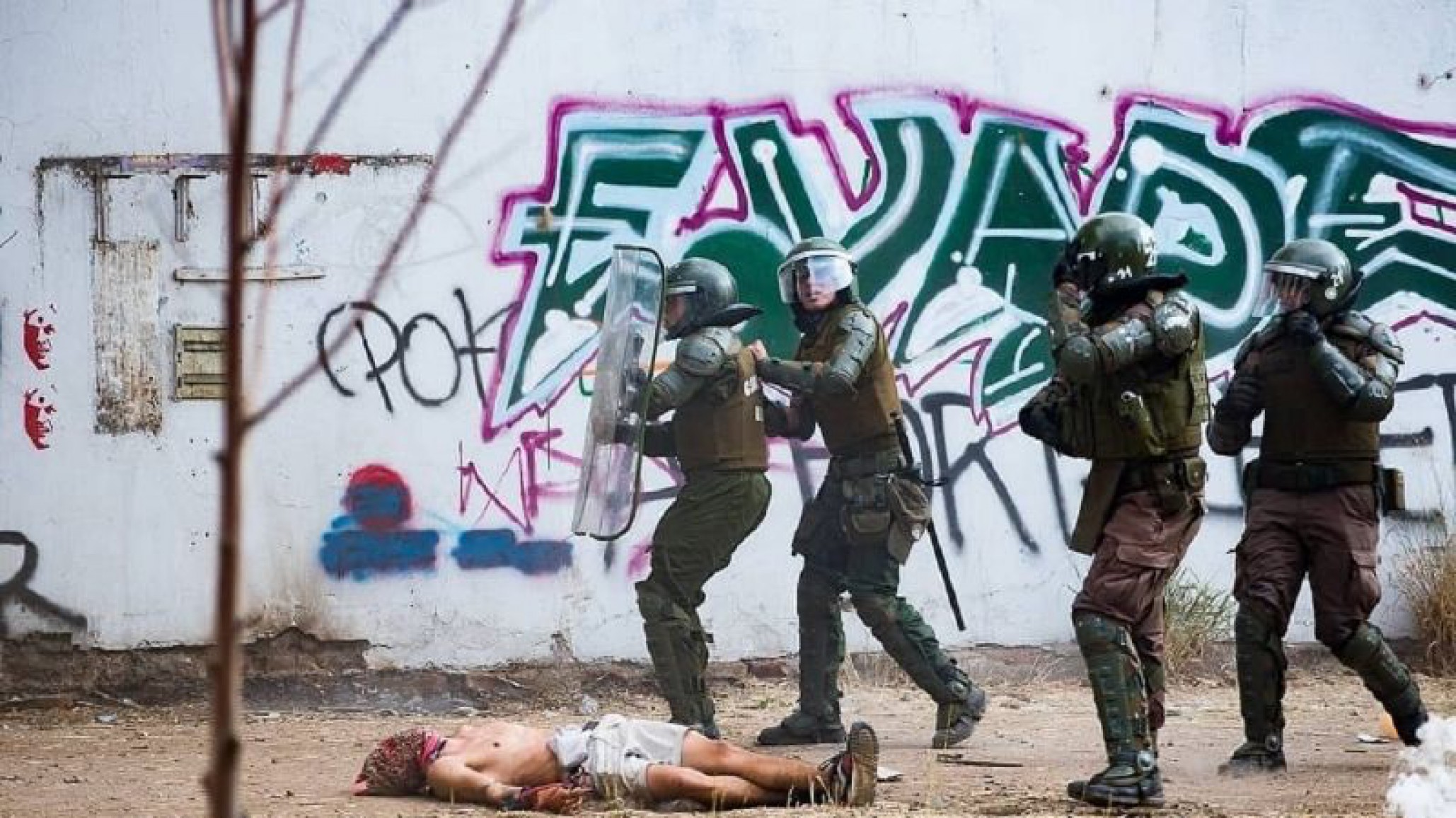 Chile: joven manifestante sufre una fractura craneal y pérdida de masa encefálica por el impacto de una bomba lacrimógena